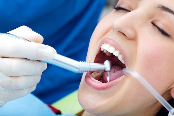 Limpeza Dental e Profilaxia em Marília
